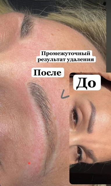 Удаление: до и промежуточный результат